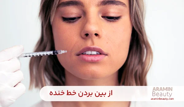 از بین بردن خط خنده 