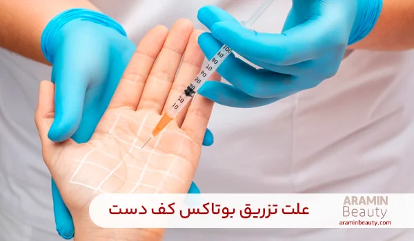 علت بوتاکس کف دست