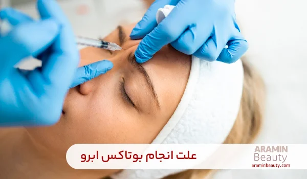 علت بوتاکس ابرو
