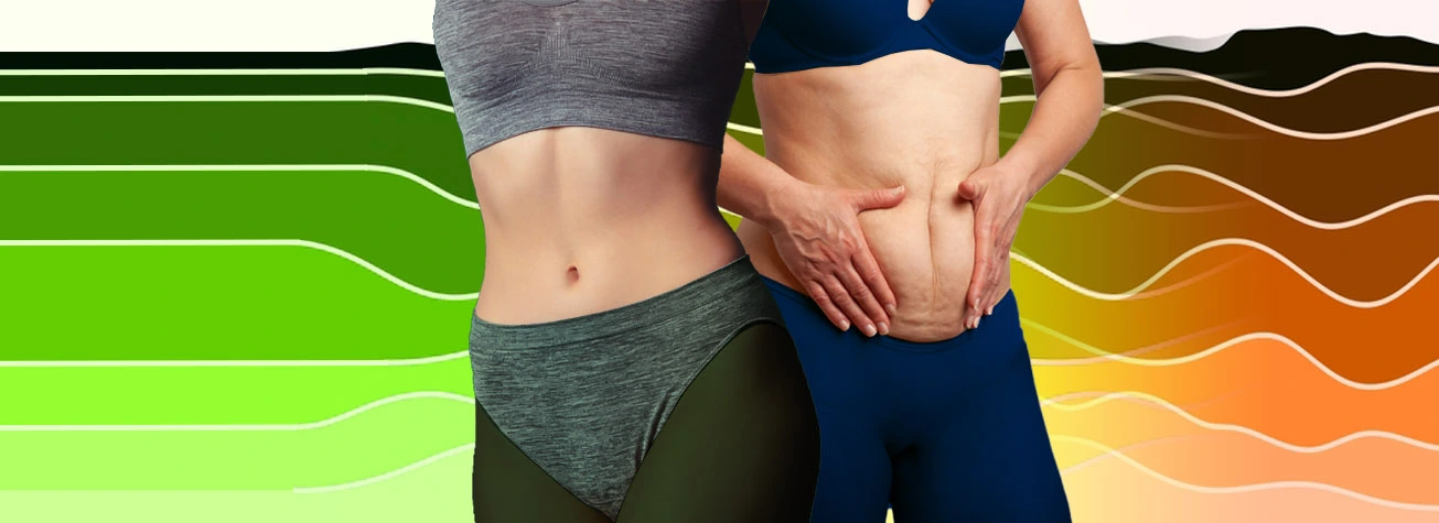 هایفوتراپی شکم چیست؛ همه چیز درباره هایفو برای لاغری شکم و پهلو