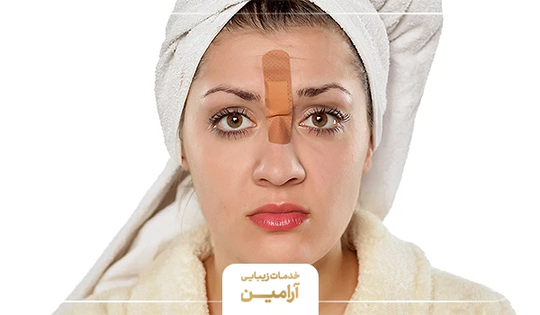 عوارض لیزر موهای زائد