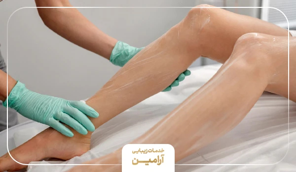 مراقبت بعد از لیزر