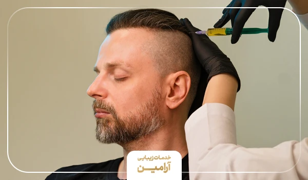 عوارض نادر پی آر پی موی سر