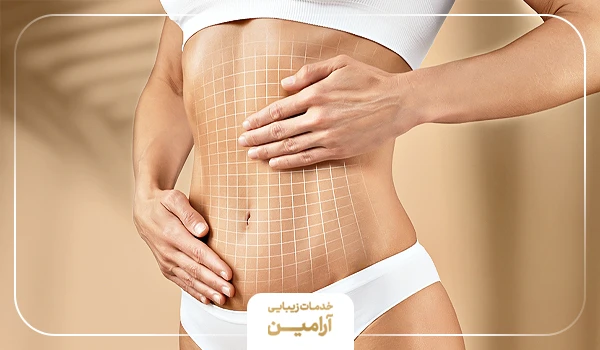 مراقبتهای بعد از امبدینگ