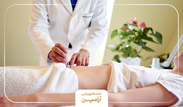 روش انجام طب سوزنی