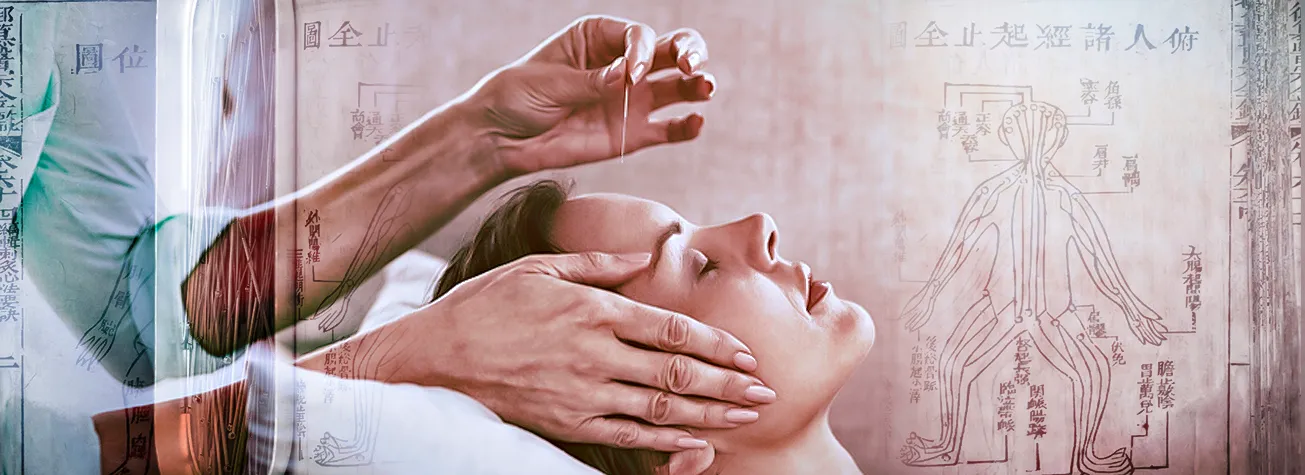 طب سوزنی چیست و چه بیماریهایی را درمان میکند؛ 0 تا 100 طب سوزنی