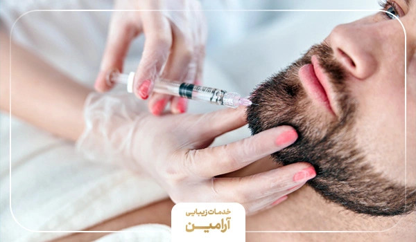 فراِند تزریق مزوتراپی برای ریش