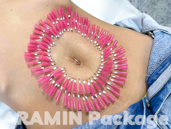 امبدینگ + مزو چربی سوز