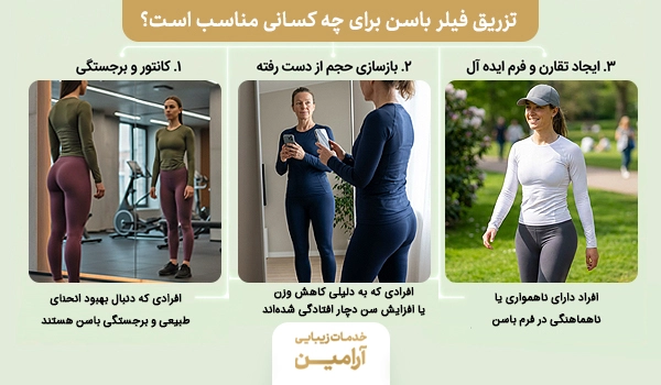 کاندیداهای تزریق ژل به باسن