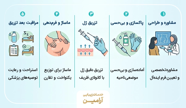 مراحل تزریق فیلر باسن